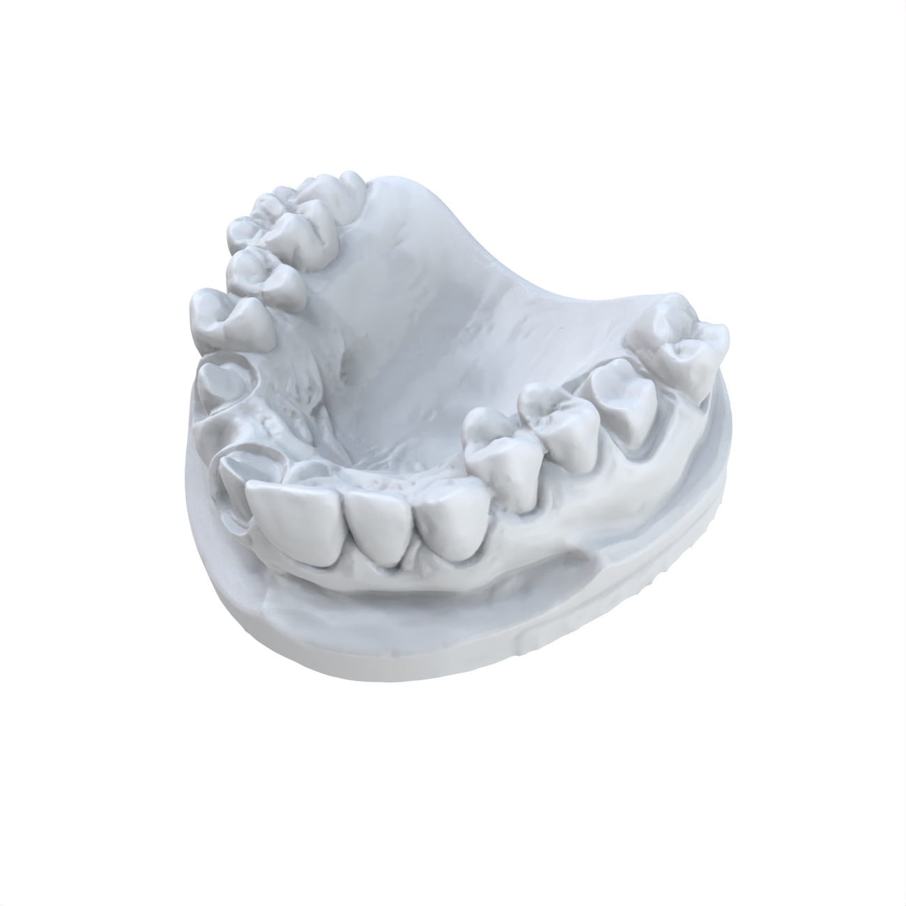 1 PCS Modello dentale Preferit - 3D Printing Dental recensione e prezzo