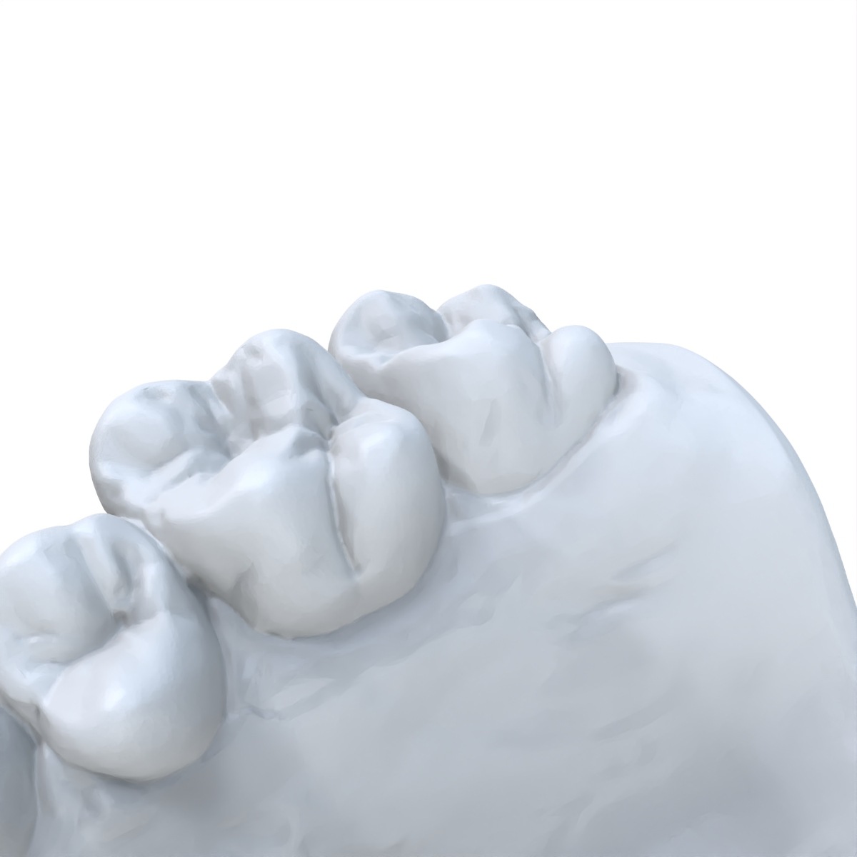 1 PCS Modello dentale Preferit - 3D Printing Dental recensione e prezzo